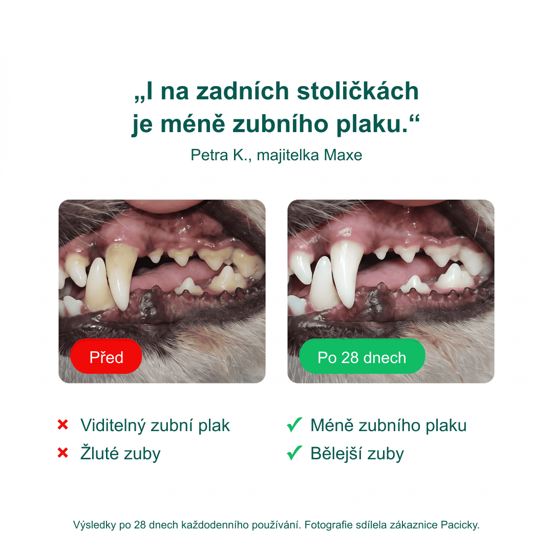 Péče o Zuby